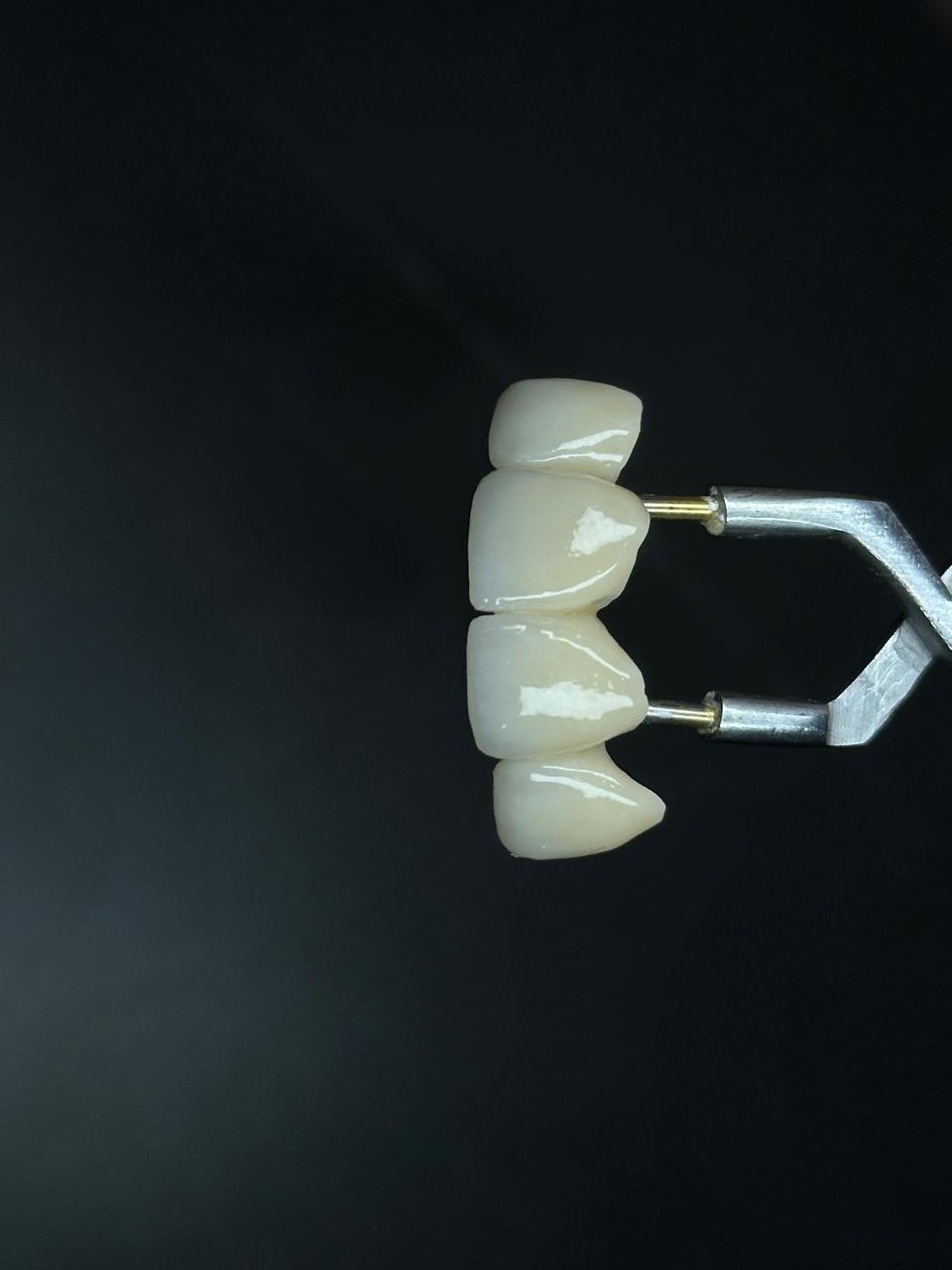 OctaDent Lab gallery photo